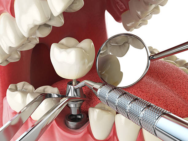 Best After-Hours Dental Care in Doraville, GA